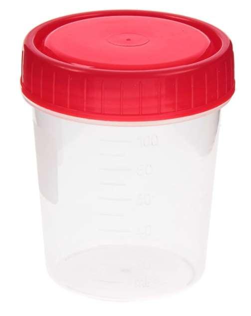 Анализы мочи