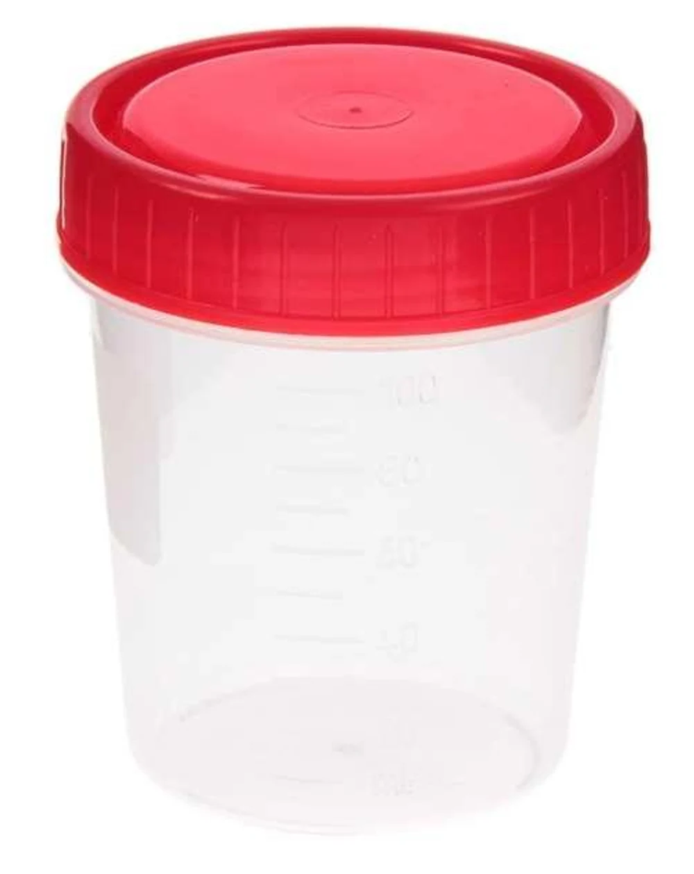 Анализы мочи